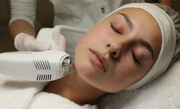 How Tixel Skin Resurfacing works